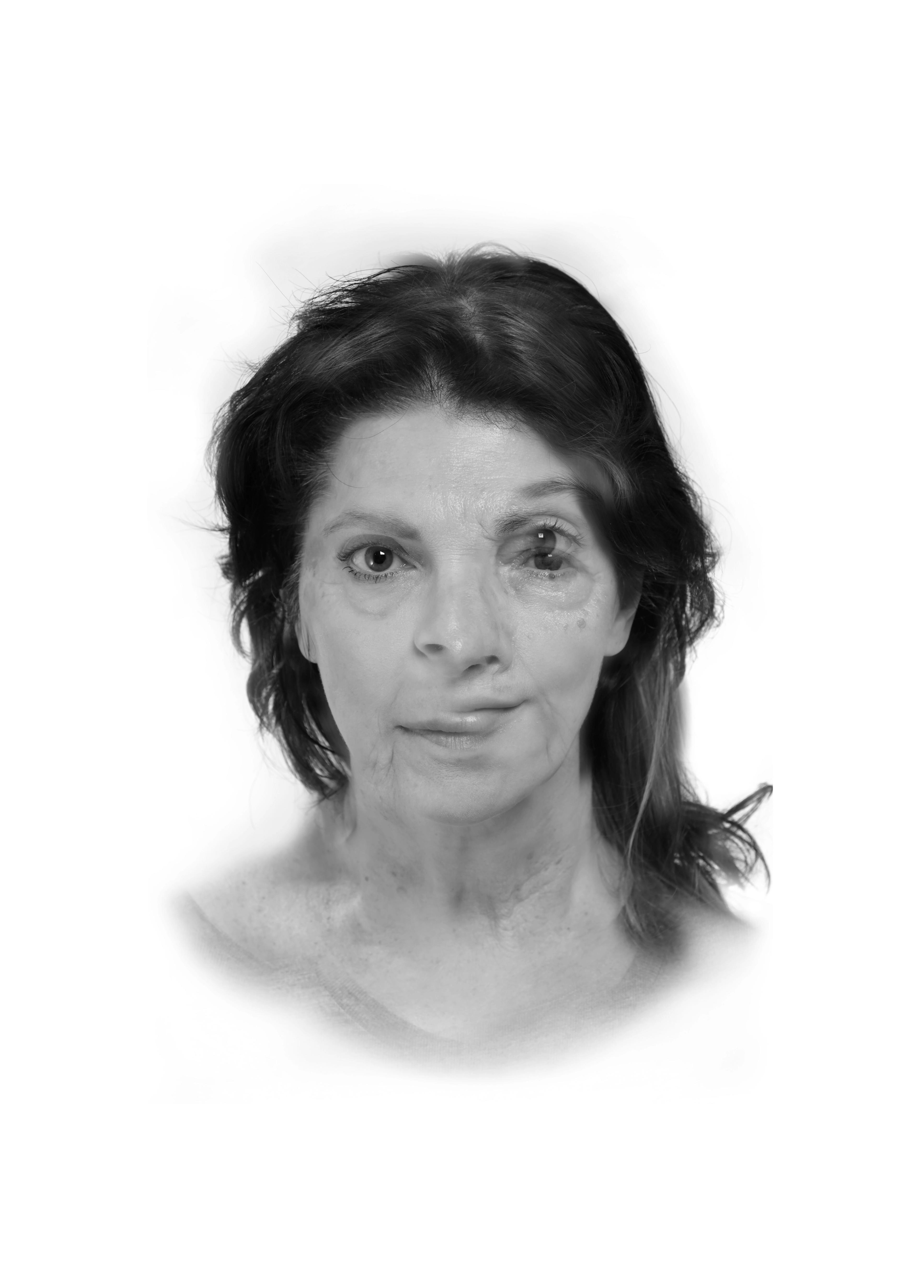 Svartvitt porträtt av en kvinna med mörkt hår, där ansiktet är digitalt manipulerat och delvis överlappande för att skapa en dubbelbildseffekt. Verket skildrar teman kring identitet, självbild och tidens spår. Del av Šejla Kamerićs serie Ex You Portrait (2025).