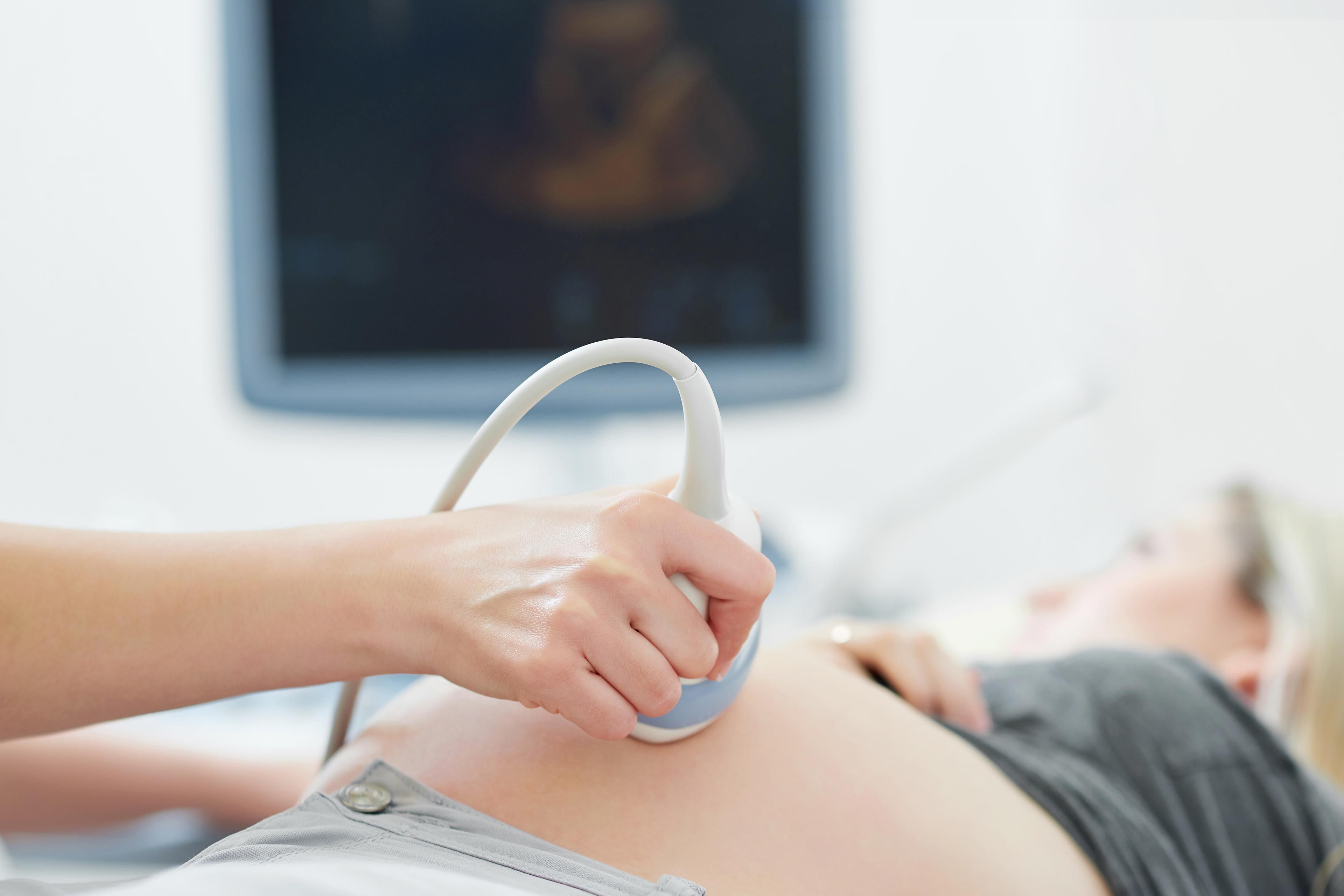 Eine Hand hält eine Ultraschallsonde, die auf den Bauch einer Person gehalten wird.