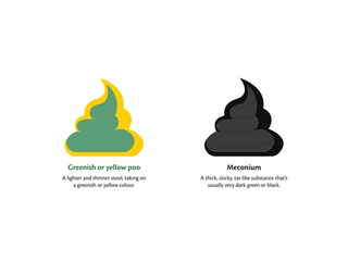 Graphic showing what normal newborn baby poop may look like