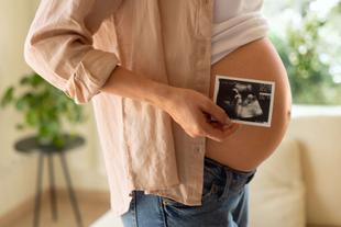 Eine Person hält ein Ultraschallfoto eines Babys in der Hand, auf dem die Silhouette des Babys zu sehen ist.