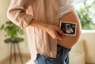 Eine Person hält ein Ultraschallfoto eines Babys in der Hand, auf dem die Silhouette des Babys zu sehen ist.