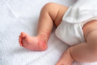 Fuß und Unterschenkel des Babys auf einem weißen Handtuch.