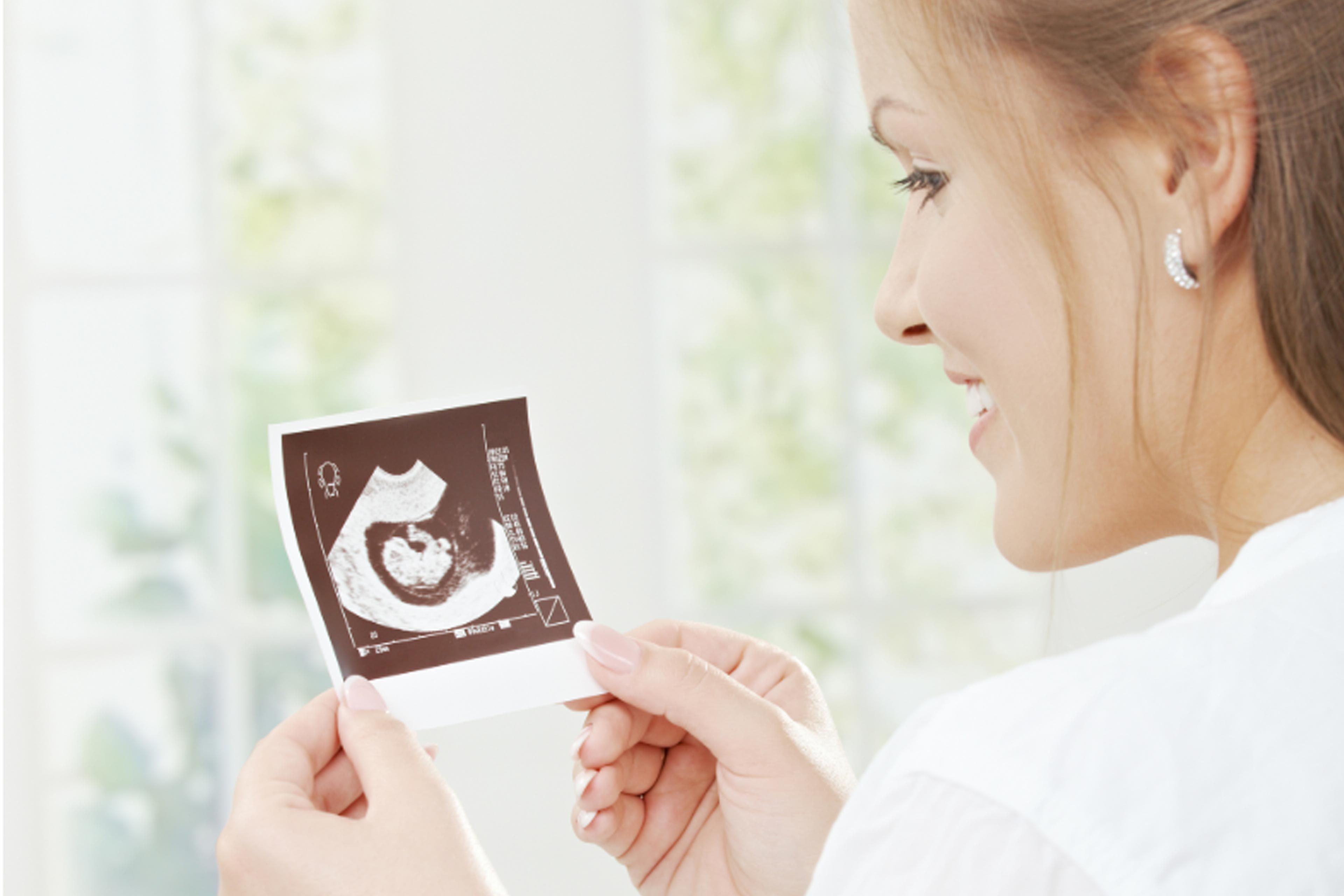 Eine Frau hält eine Ultraschalluntersuchung eines Fötus.
