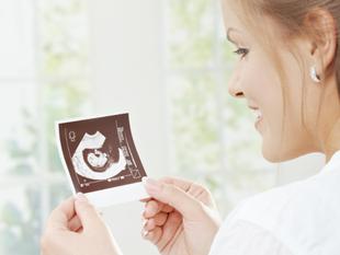 Eine Frau hält eine Ultraschalluntersuchung eines Fötus.