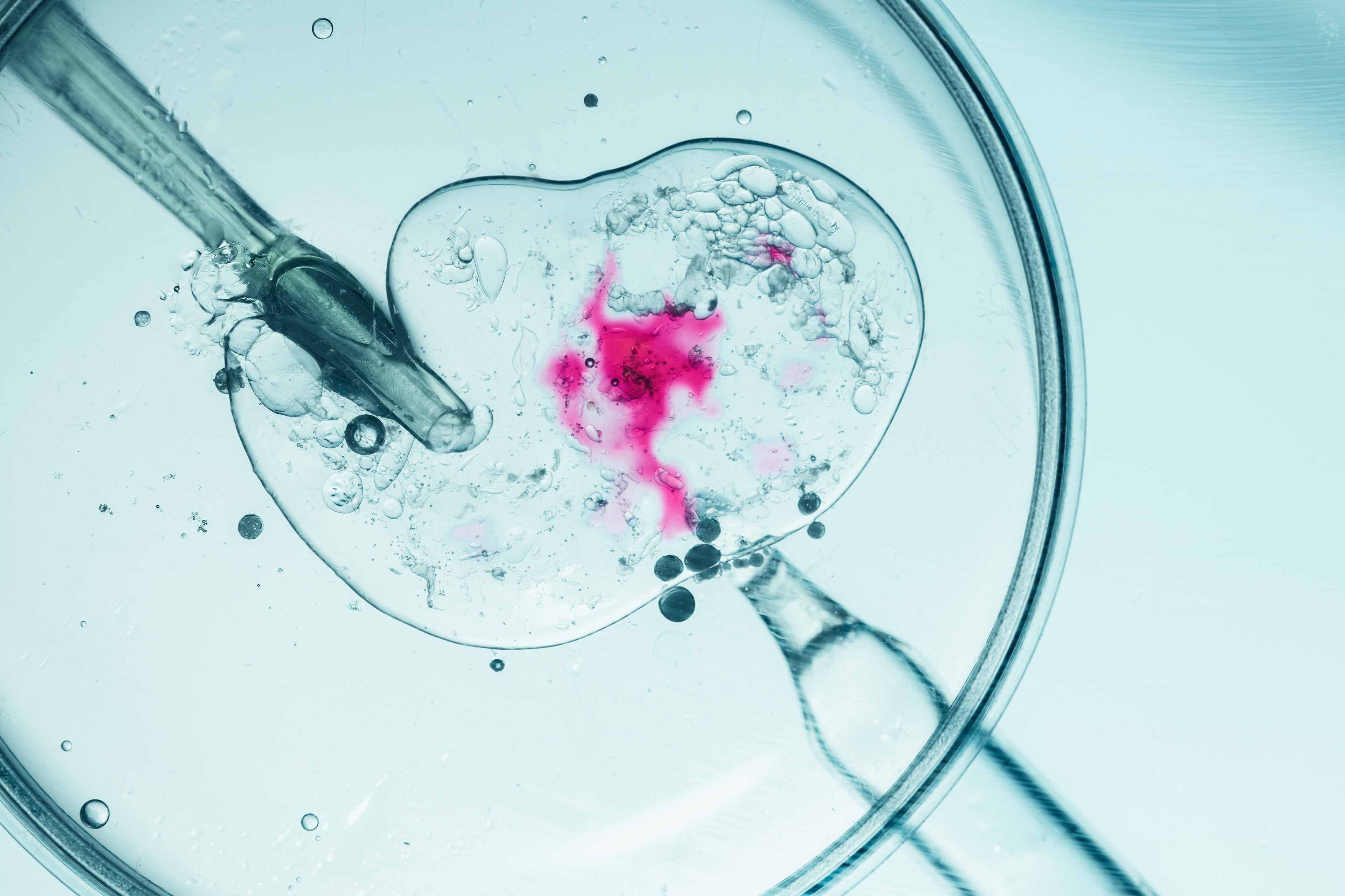 Eine Petrischale mit einer Flüssigkeit, die eine rosarote Substanz enthält, umgeben von Blasen und einer Pipette.