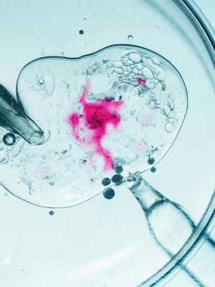 Eine Petrischale mit einer Flüssigkeit, die eine rosarote Substanz enthält, umgeben von Blasen und einer Pipette.