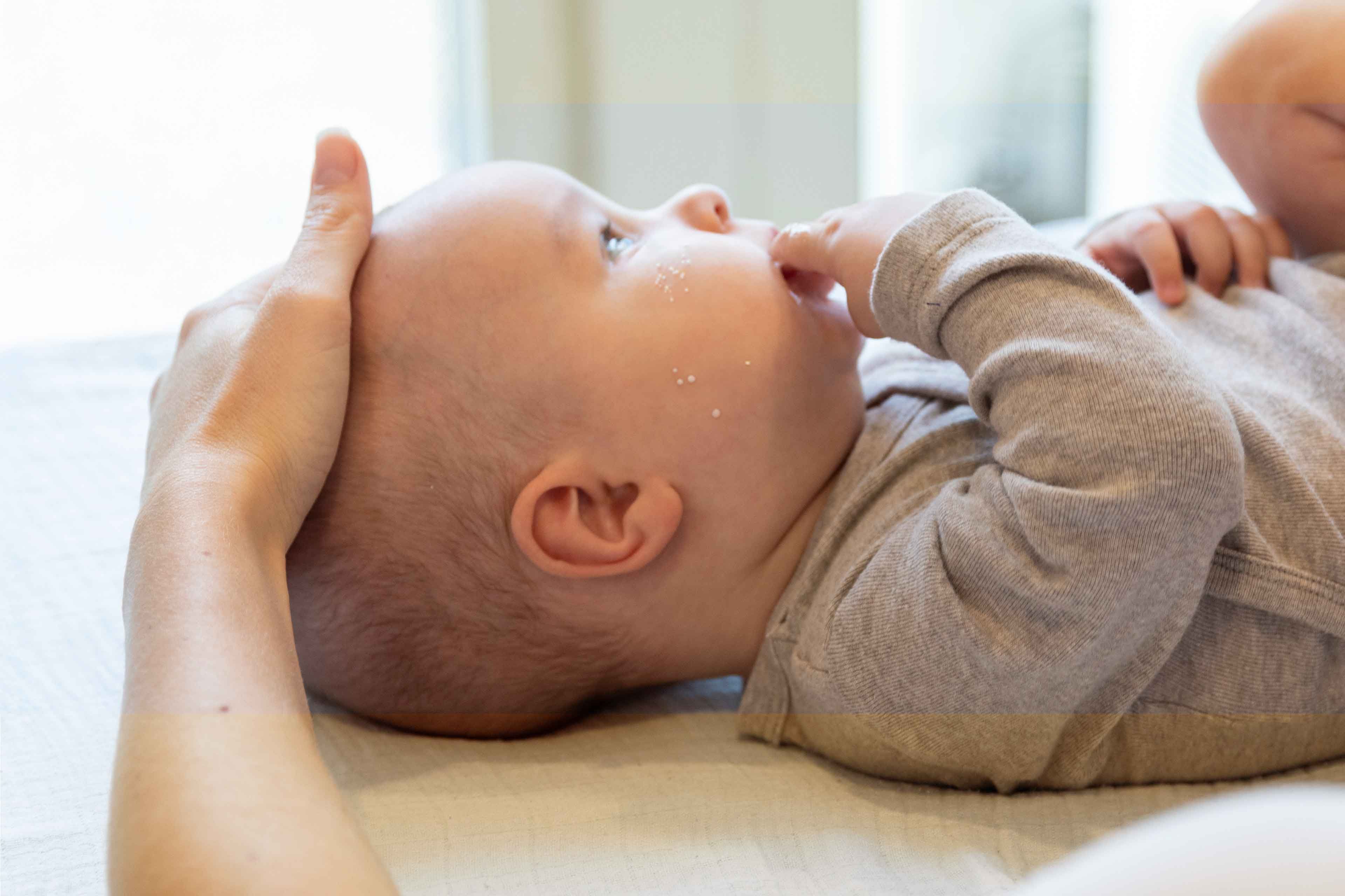 Baby mit kleinen weißen Körnchen im Gesicht.