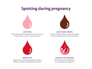 Infographic showing different colours of spotting in pregnancy with brief explanations of what each type may mean.