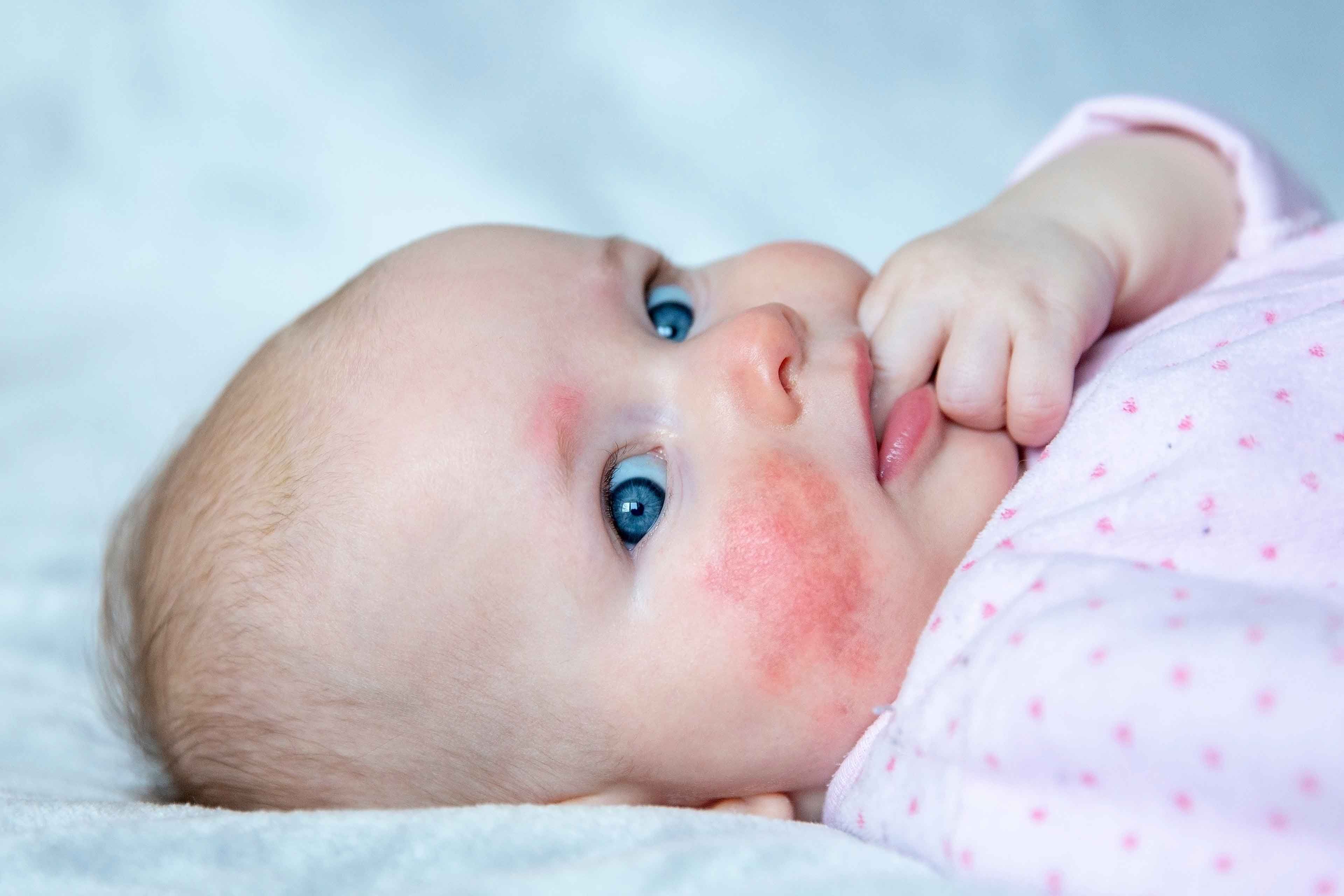 Ein Baby mit blauen Augen, das auf einer weißen Fläche liegt und eine Hand in der Nähe seines Gesichts hat.