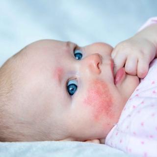 Ein Baby mit blauen Augen, das auf einer weißen Fläche liegt und eine Hand in der Nähe seines Gesichts hat.