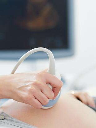 Eine medizinische Fachkraft, die während einer Ultraschalluntersuchung eine Sonde auf dem Bauch eines Patienten einsetzt.