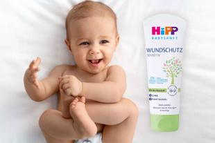Ein Baby mit freudigem Gesichtsausdruck, das auf einer weißen Fläche liegt, neben einer Tube "WUNDSCHUTZ SENSITIV"-Creme, die mit "Mit Bio-Mandelblend", "21% Panthenol" und "Parfumfrei" gekennzeichnet ist.