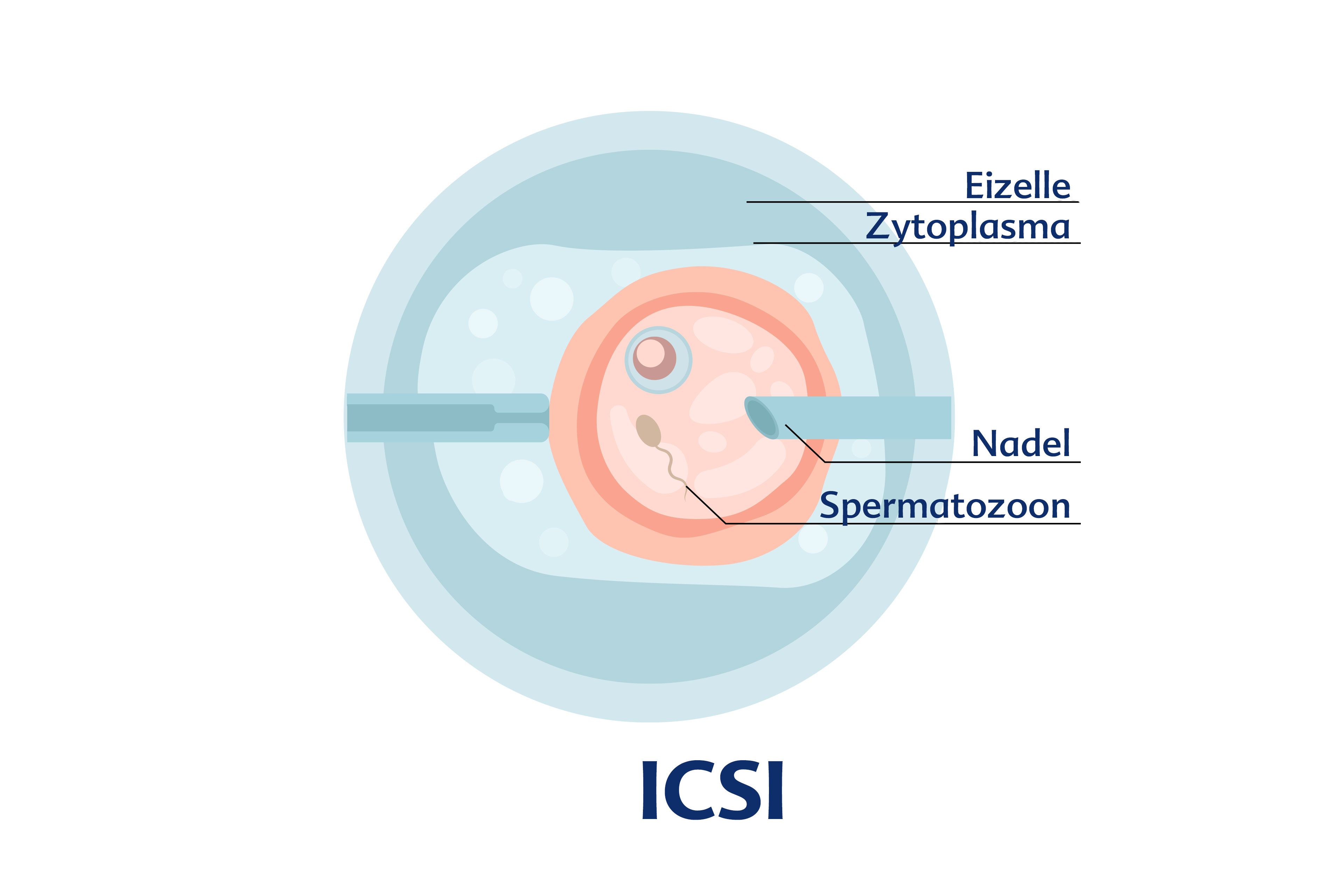 Die innere Struktur eines Embryos, wobei die Eizelle, das Zytoplasma, die Nadel und die Spermatozone hervorgehoben werden.