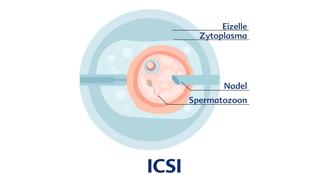Die innere Struktur eines Embryos, wobei die Eizelle, das Zytoplasma, die Nadel und die Spermatozone hervorgehoben werden.
