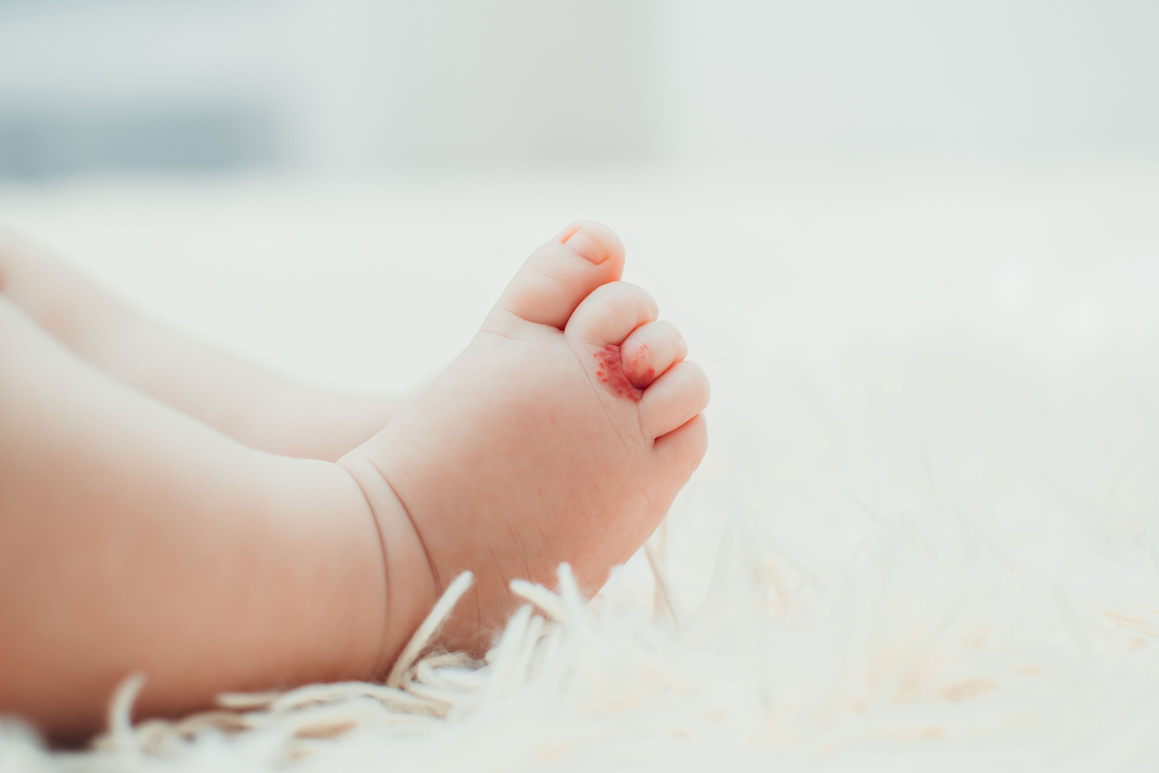 Babyfuß mit einem roten Fleck auf einer weißen, flauschigen Oberfläche.