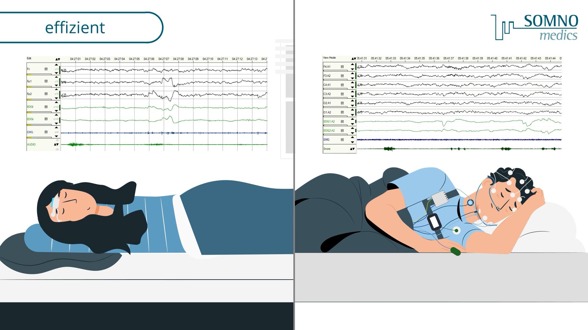 SOMNOmedics | Erklärvideo | Home Sleep Test – Bild 1