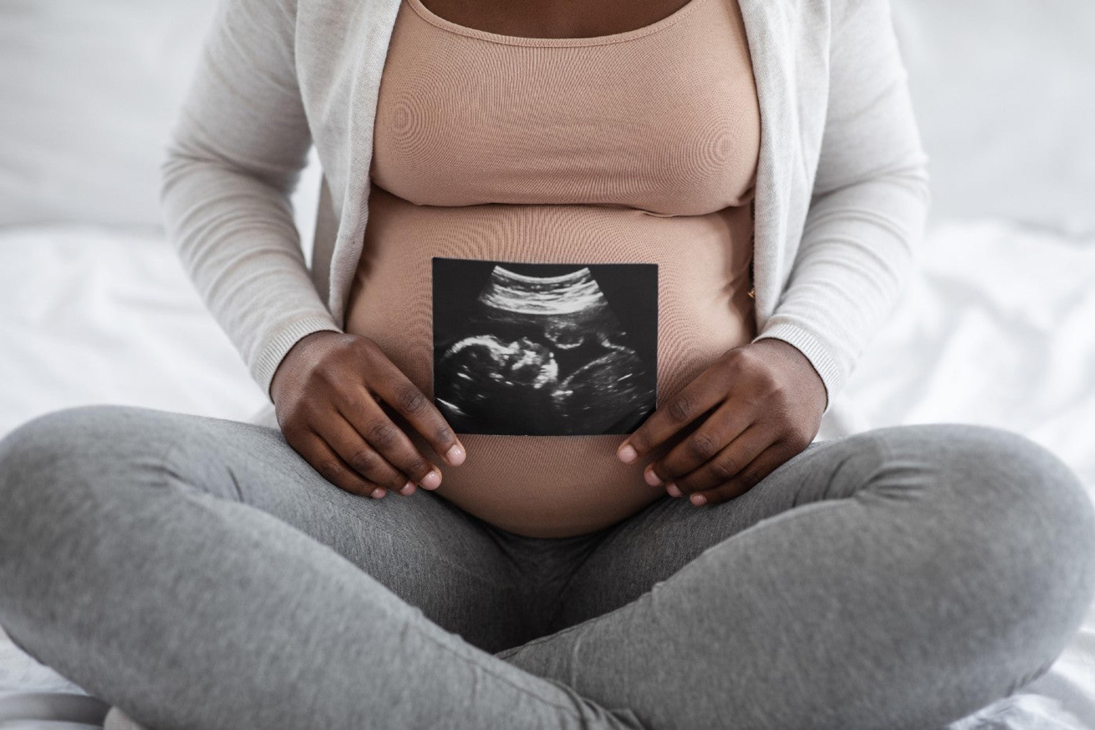 DIY pregnancy announcement photo of a mom-to-be holding an ultrasound picture