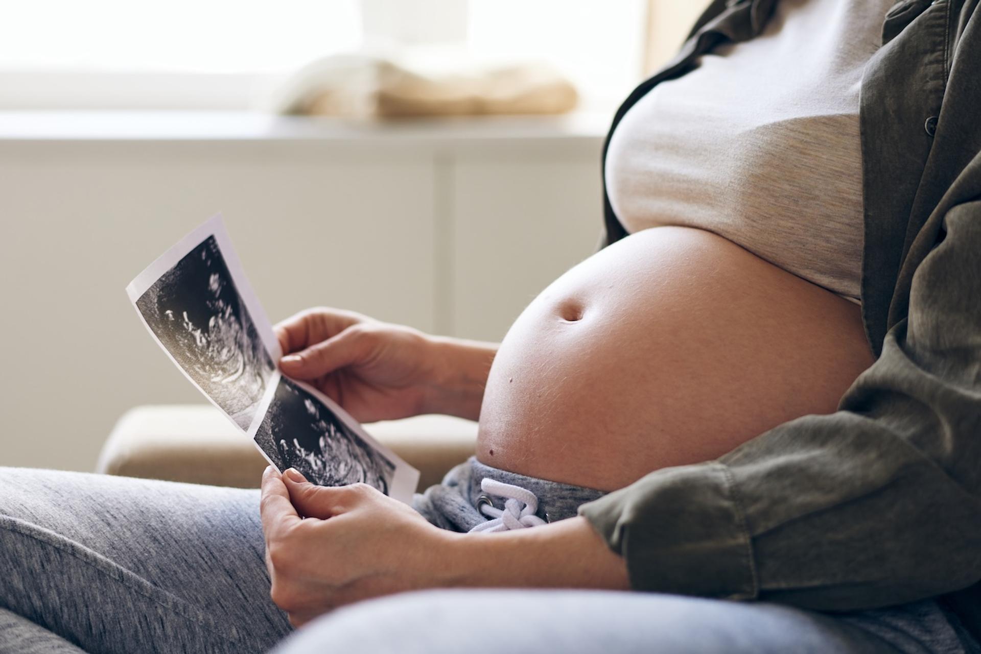 A pregnant woman looks at an ultrasound image