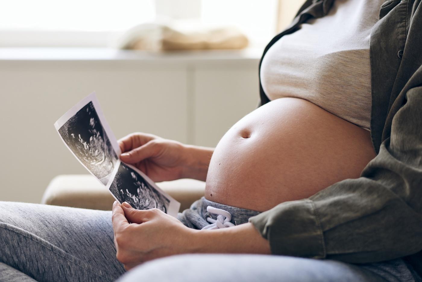 A pregnant woman looks at an ultrasound image