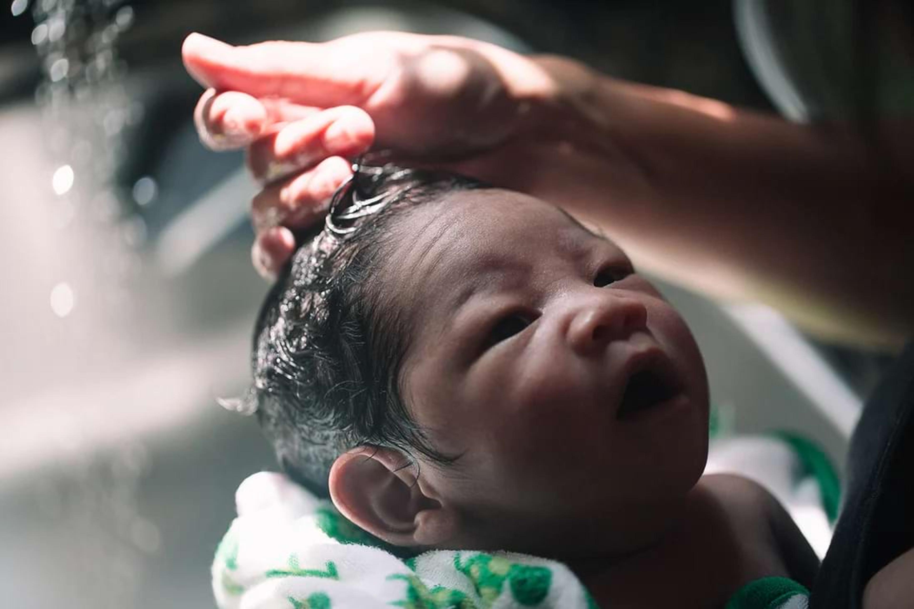 Parent washes a newborn's cradle cap