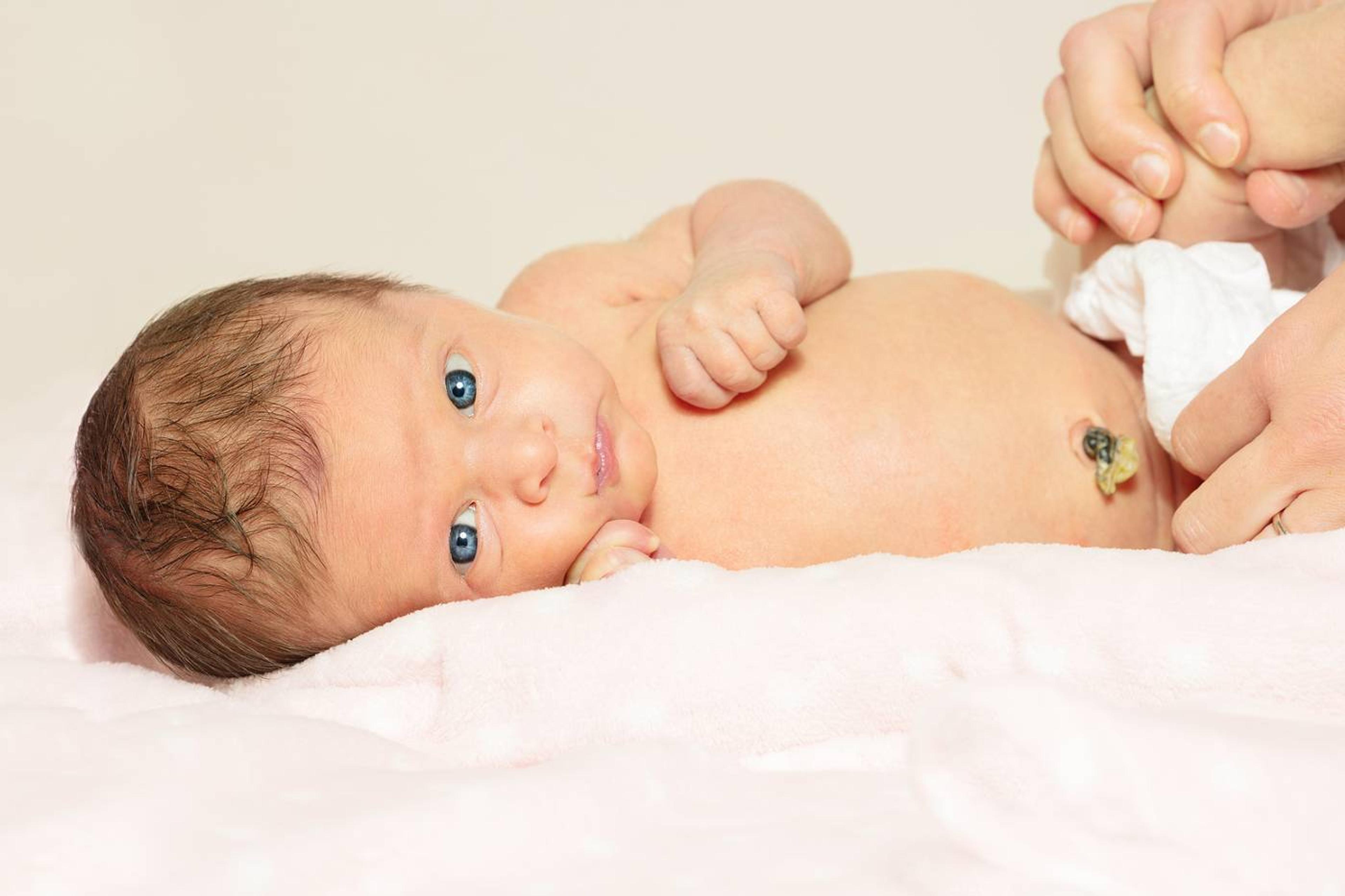 newborn: caring for umbilical cord stump