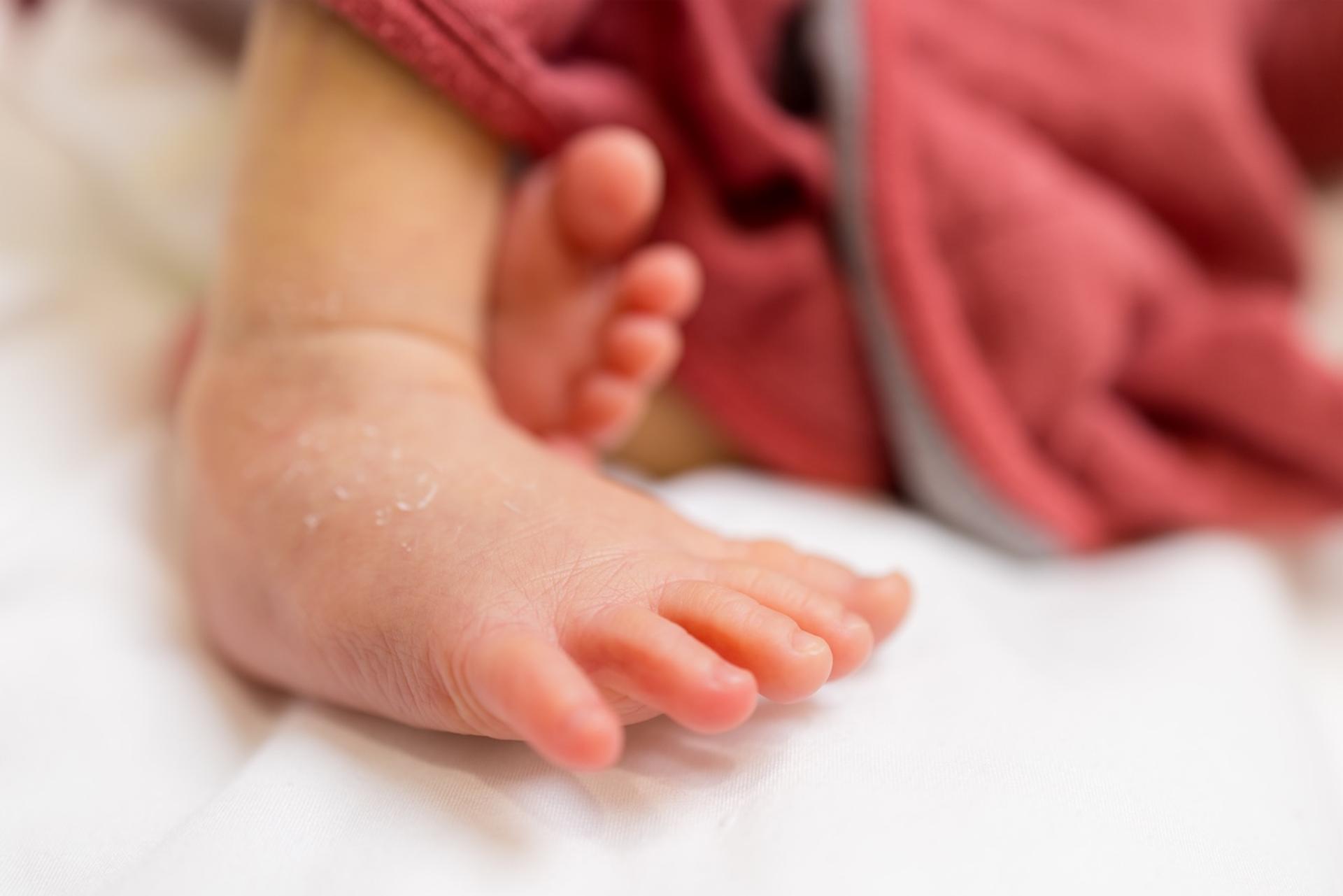 A newborn's foot with peeling skin