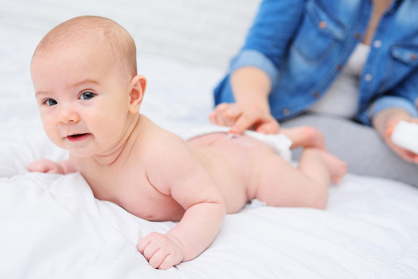 A parent applies cream to a baby's bottom to treat a diaper rash