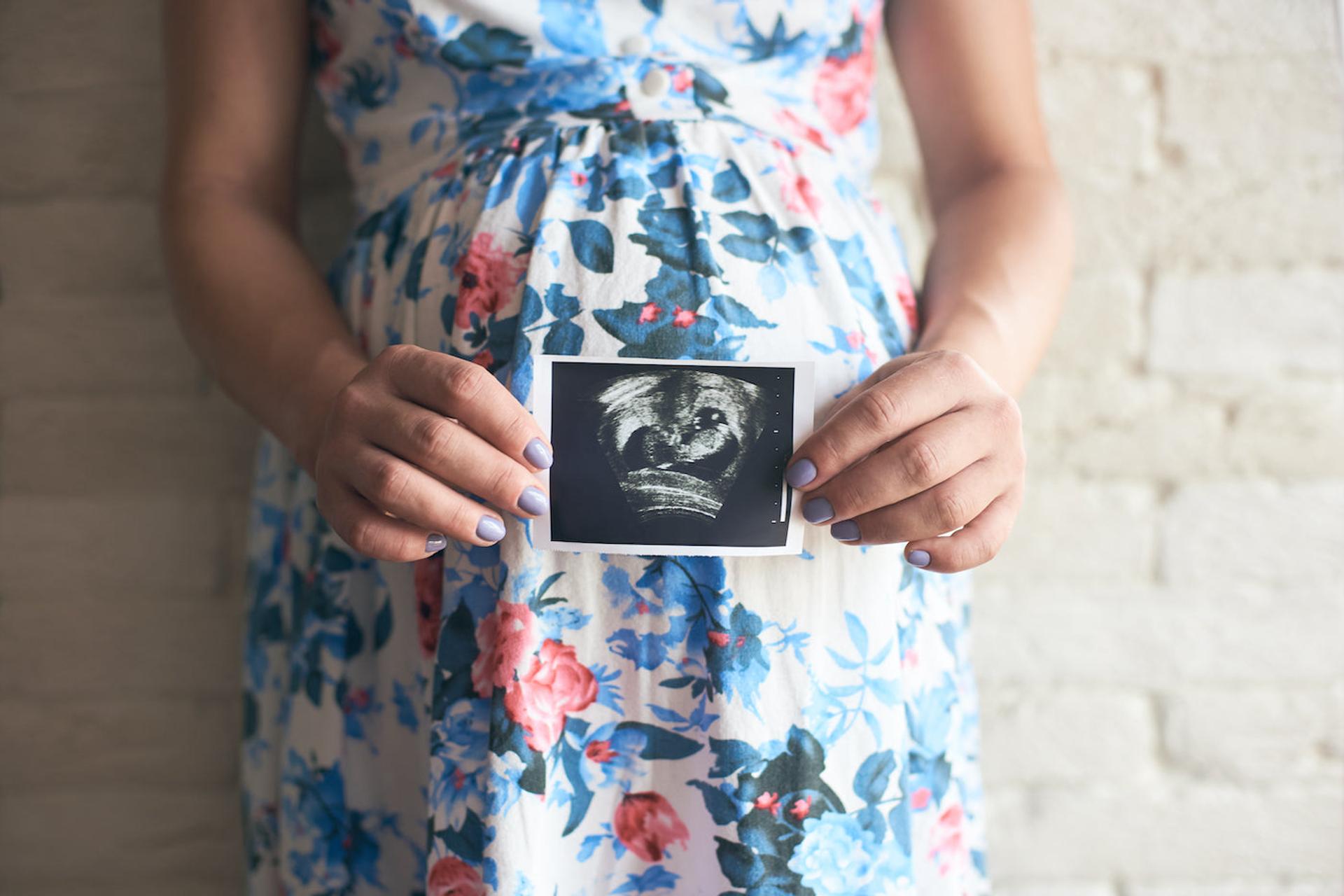 A pregnant mom makes a Mother's Day pregnancy announcement by holding an ultrasoundphoto against her bump