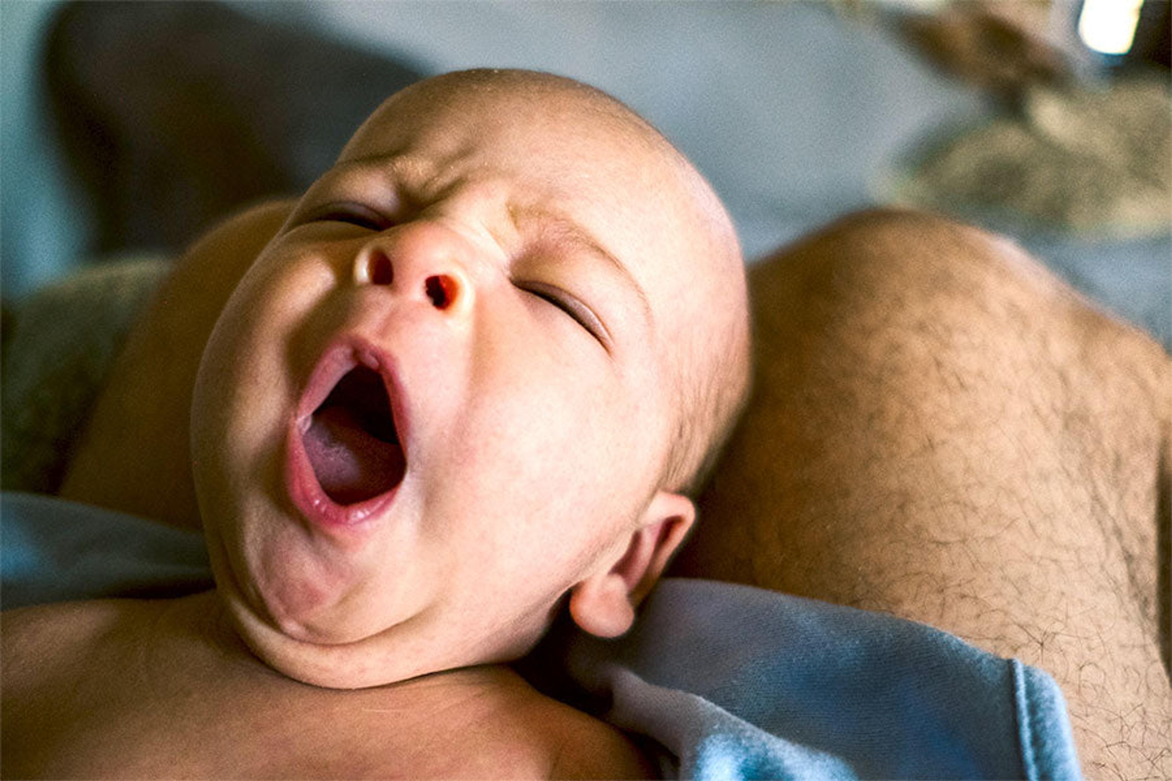 Why Are Yawns Contagious?