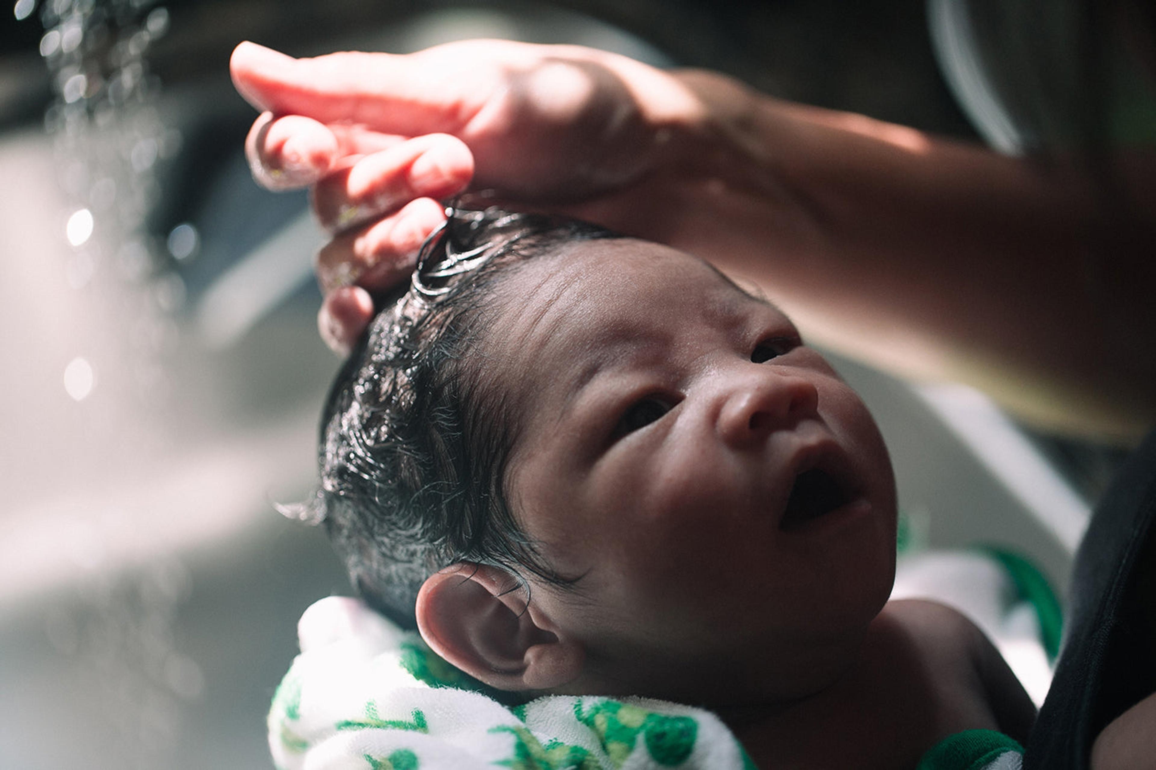 baby-bath-hair-cradle-cap