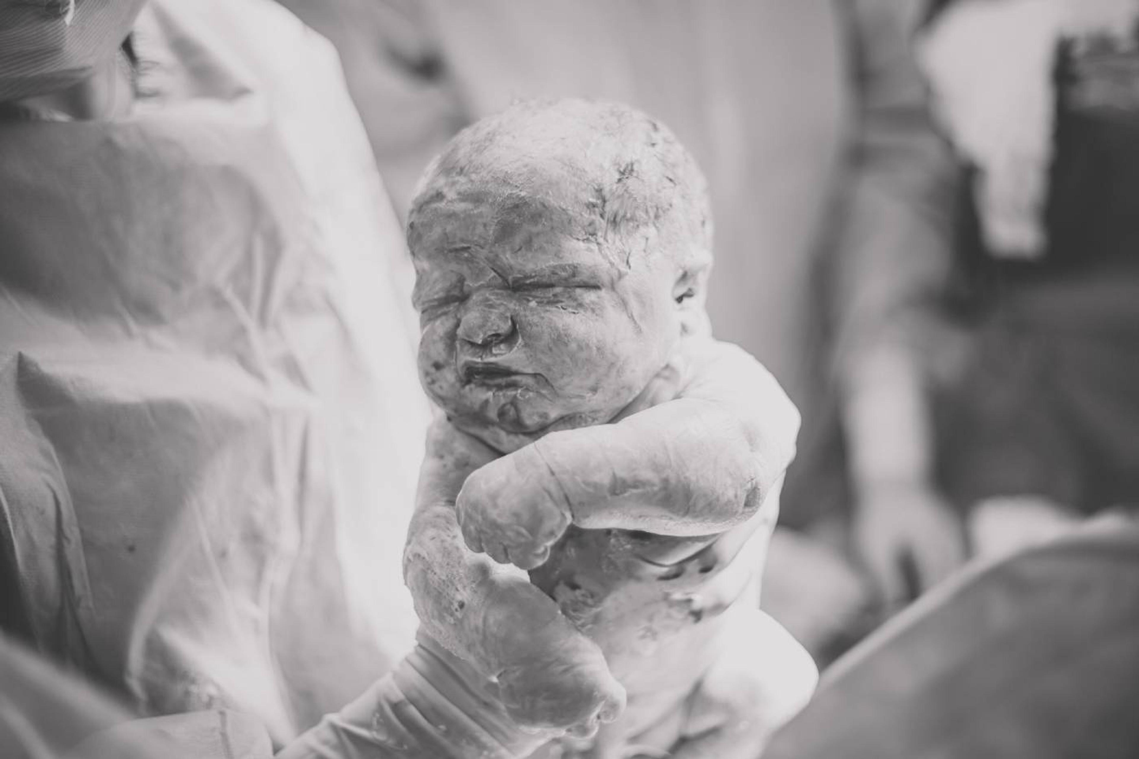 Newborn baby covered in vernix