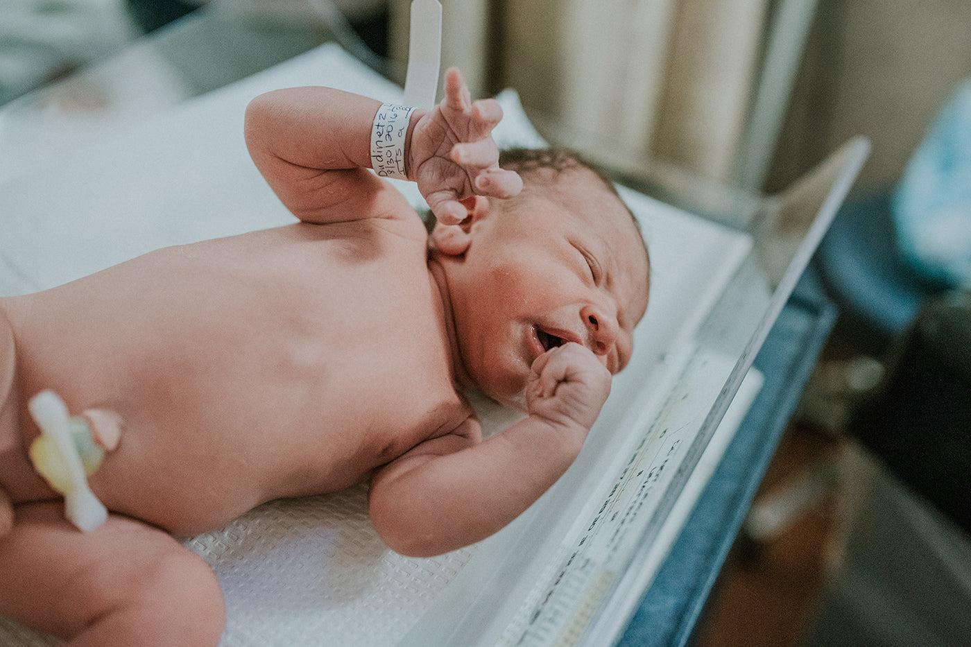 Newborn baby with recently clamped umbilical cord.