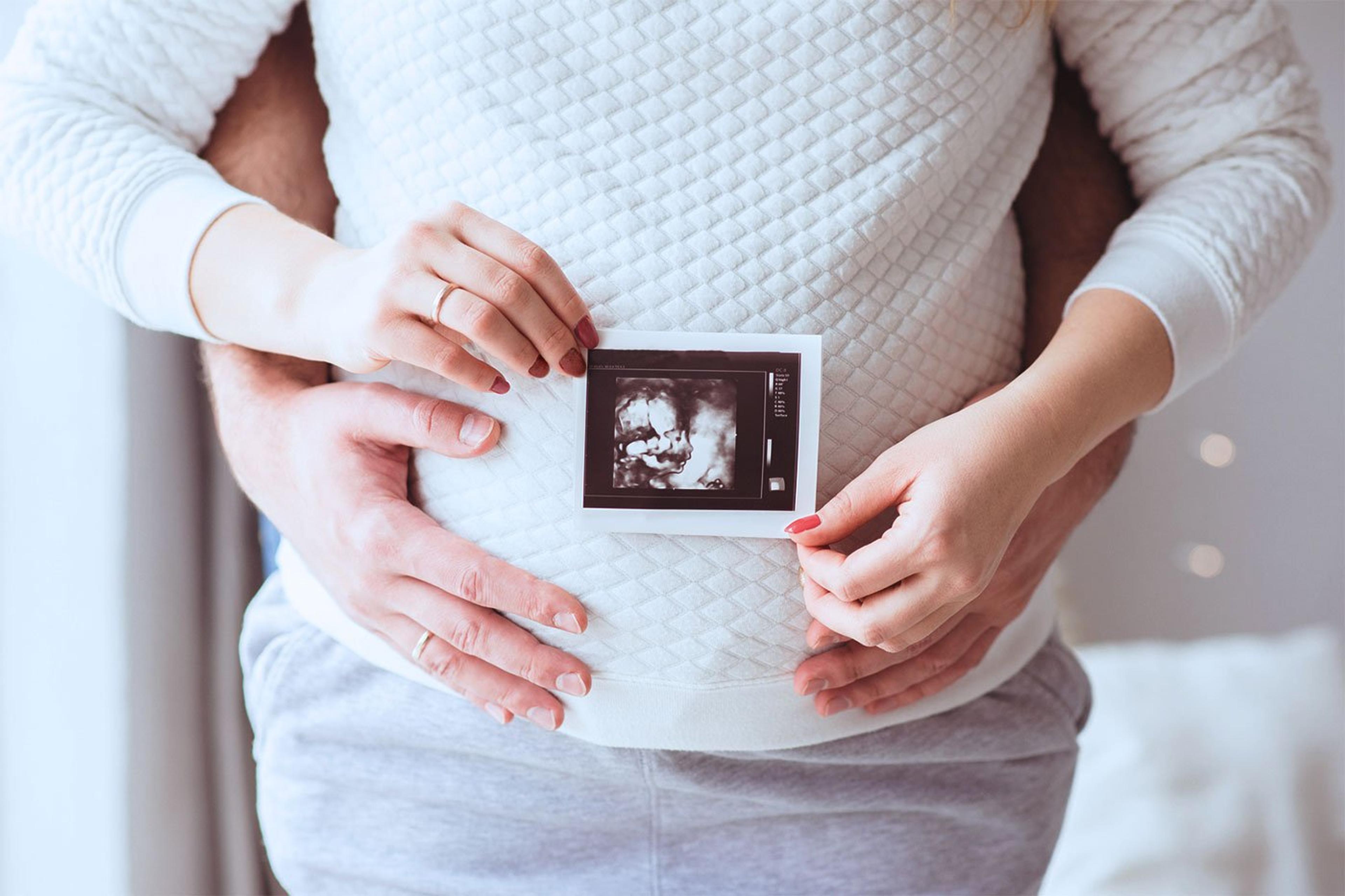 Couple holding ultrasound picture 