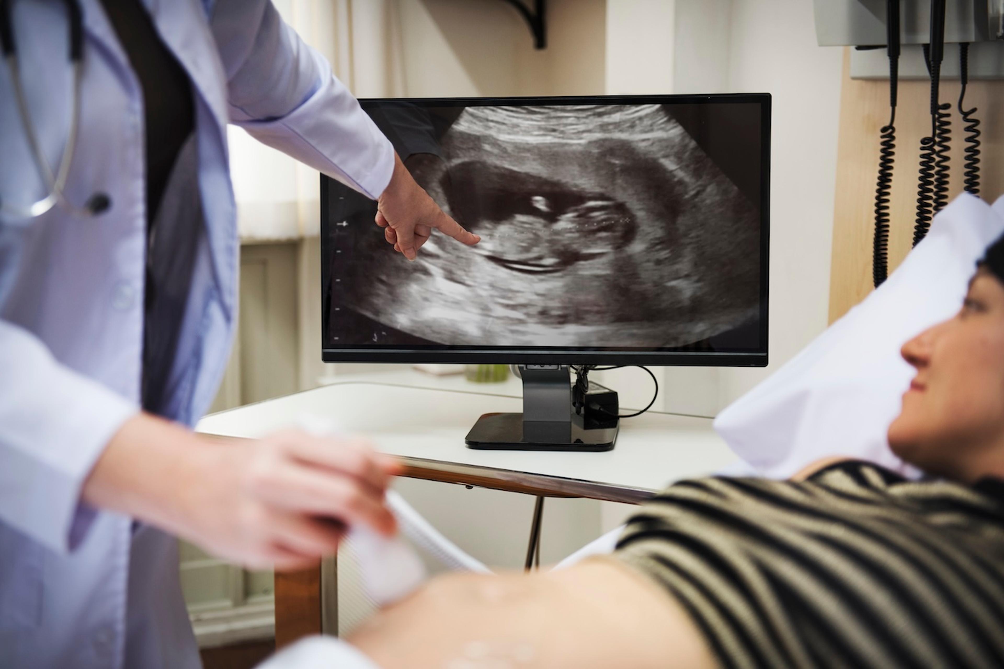 A doctor explains anatomy scan results to a pregnant woman 
