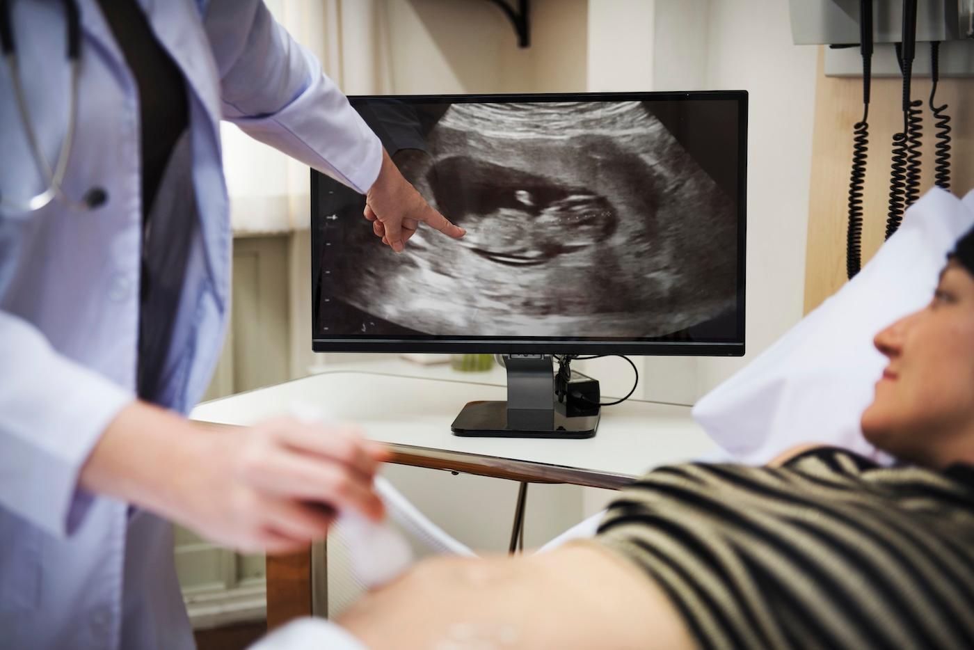 A doctor explains anatomy scan results to a pregnant woman