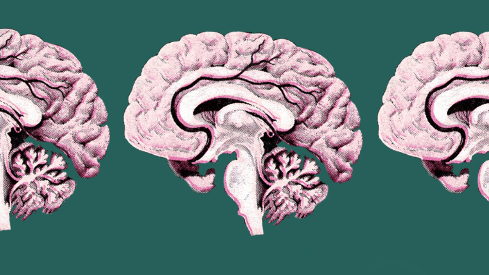 Sections through a brain.