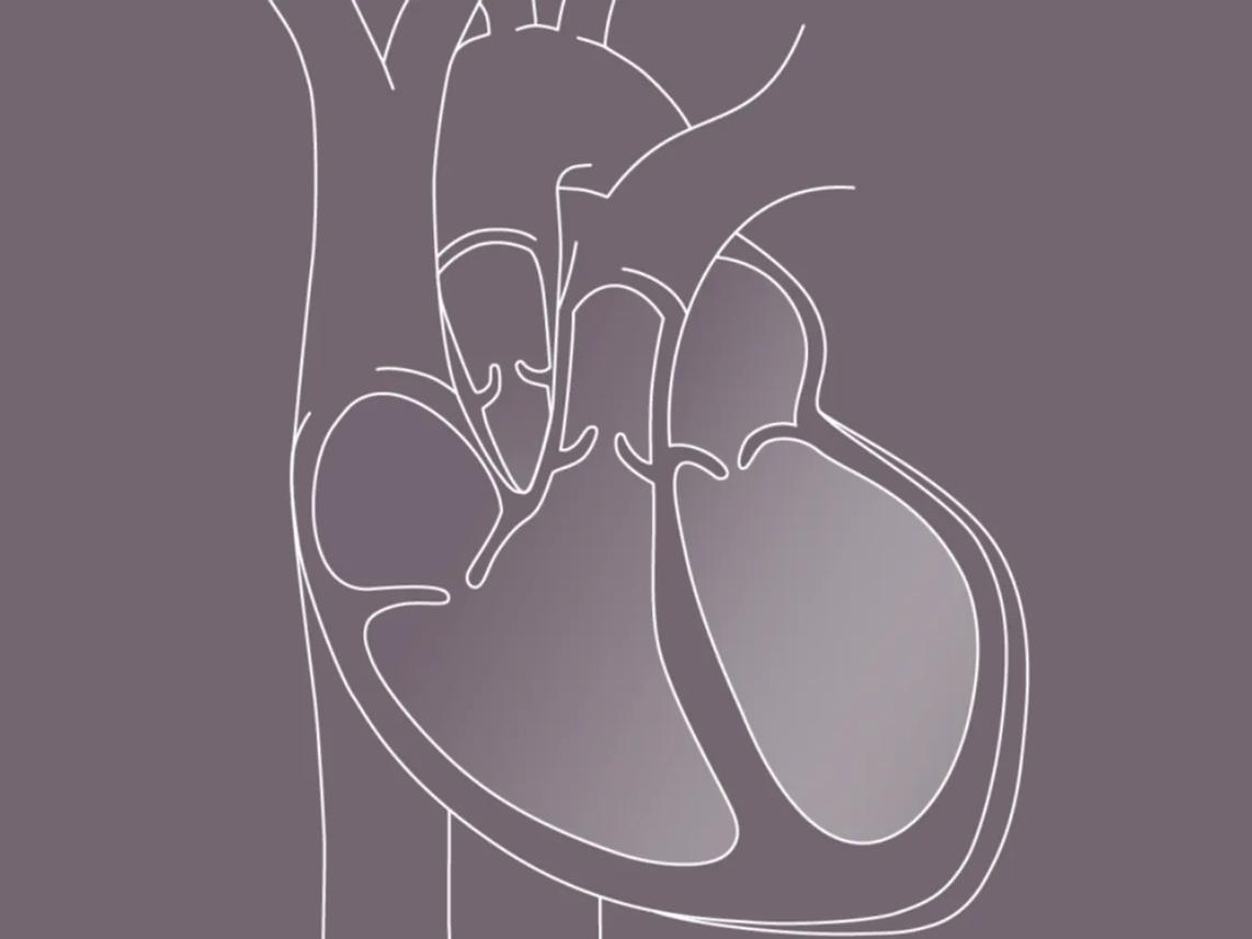 Cardior