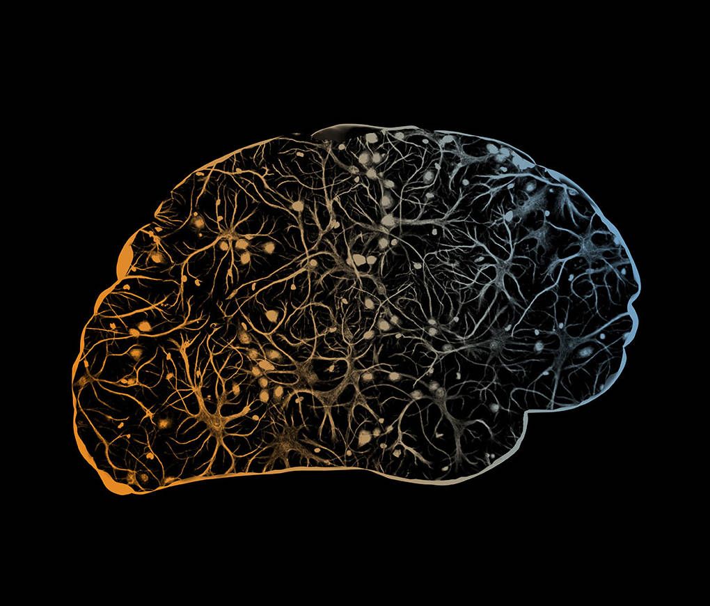 A scanned image of a brain.