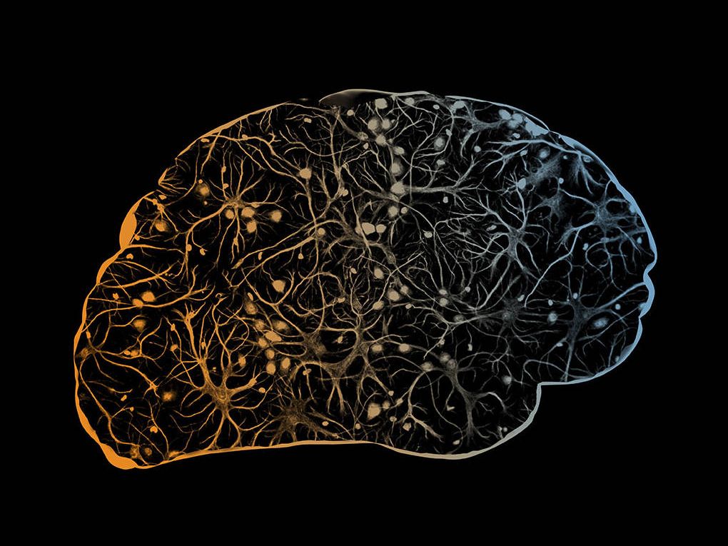 A scanned image of a brain.