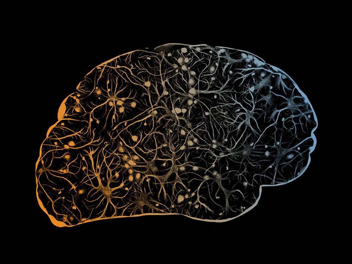 A scanned image of a brain.