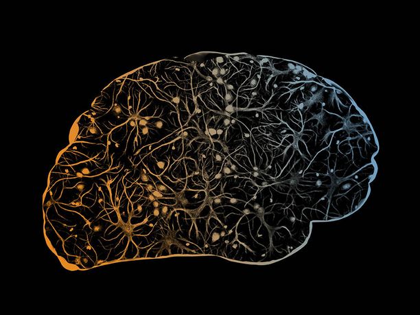 A scanned image of a brain.