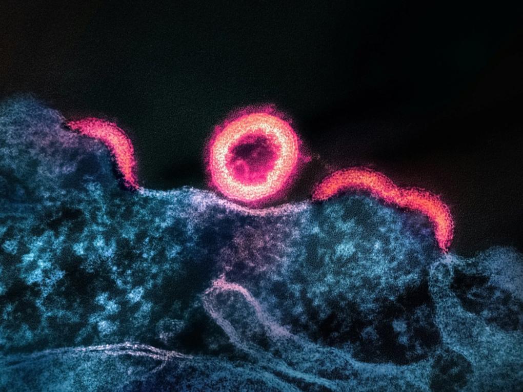 Silhouette of a person at sunrise in the mountains.