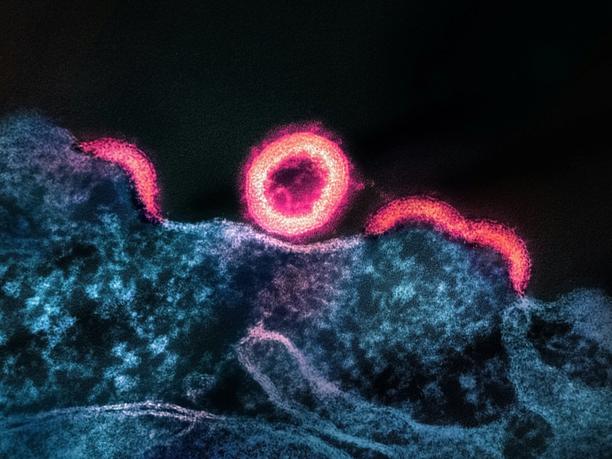 Silhouette of a person at sunrise in the mountains.