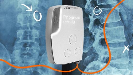 Onward Medical's ARC-EX system.