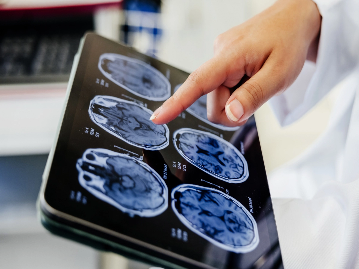 Addressing the societal burden of dementia by investing into the development of new treatments and care solutions