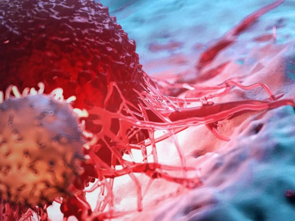 A close-up 3D rendering of a red cancer cell with intricate structures.