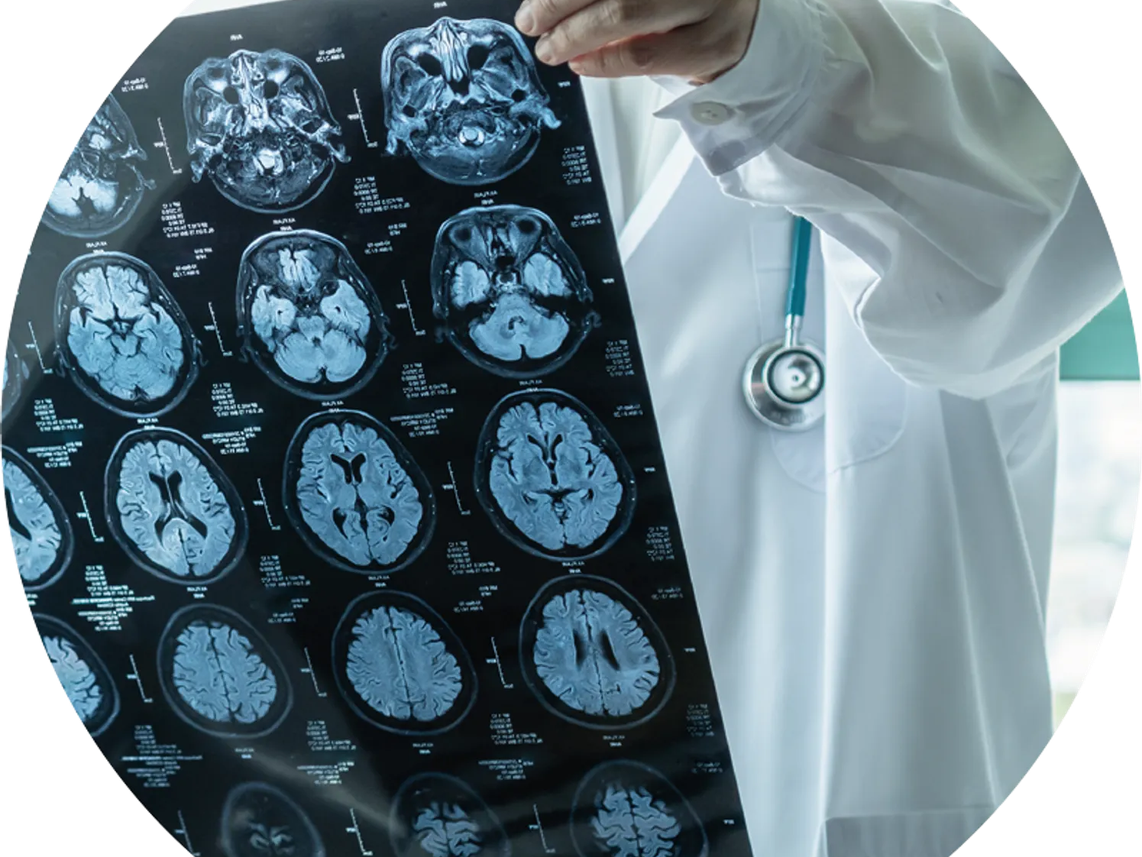 A doctor in a white coat holding up a series of brain MRI scans, with a stethoscope around their neck.