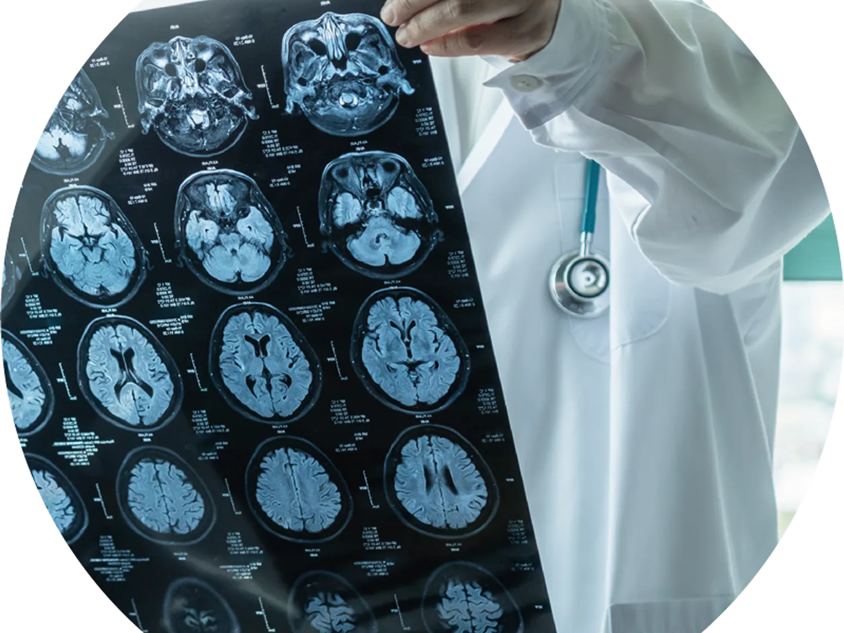 A doctor in a white coat holding up a series of brain MRI scans, with a stethoscope around their neck.