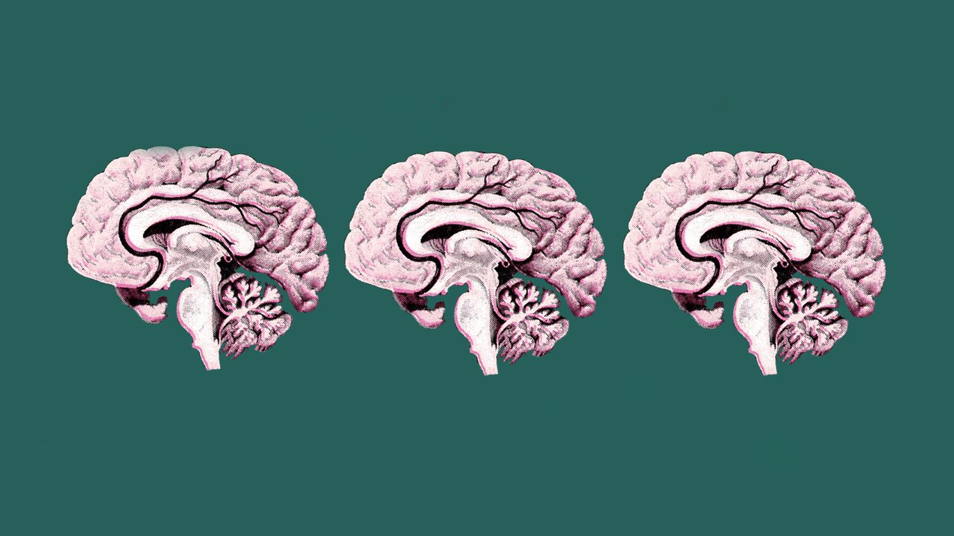 Sections through a brain.
