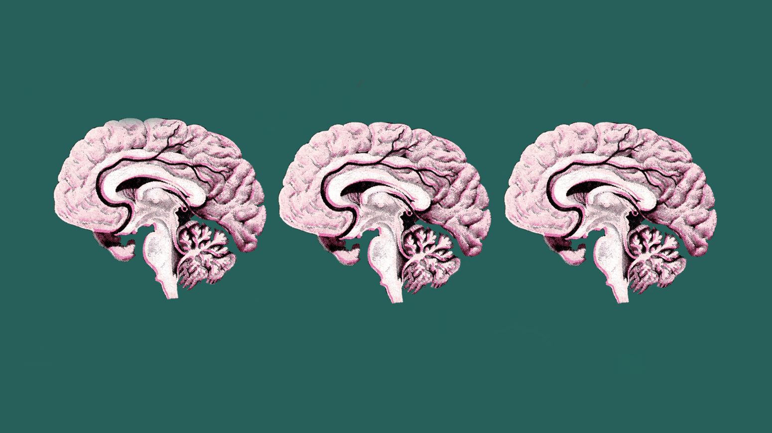 Sections through a brain.